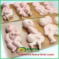 ANATOMY14(12452) Demonstrator Deformities in Infants ,8 pieces in a Series, Anatomy Models > Fetal Malformation Model 12452